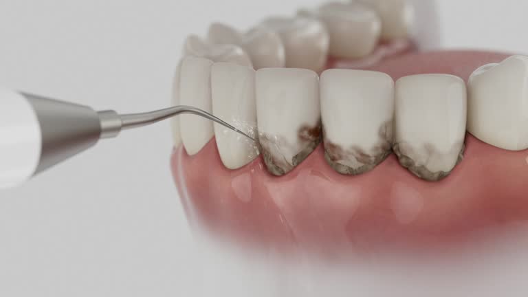 Reliable Dental Implants contractor in Hughson, CA by Smile Center Dentistry